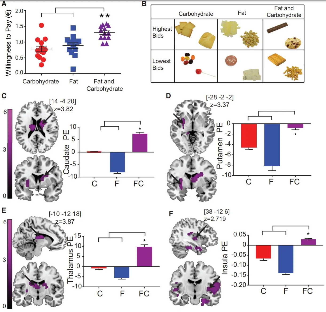 Brain Monitoring Carbs Fats